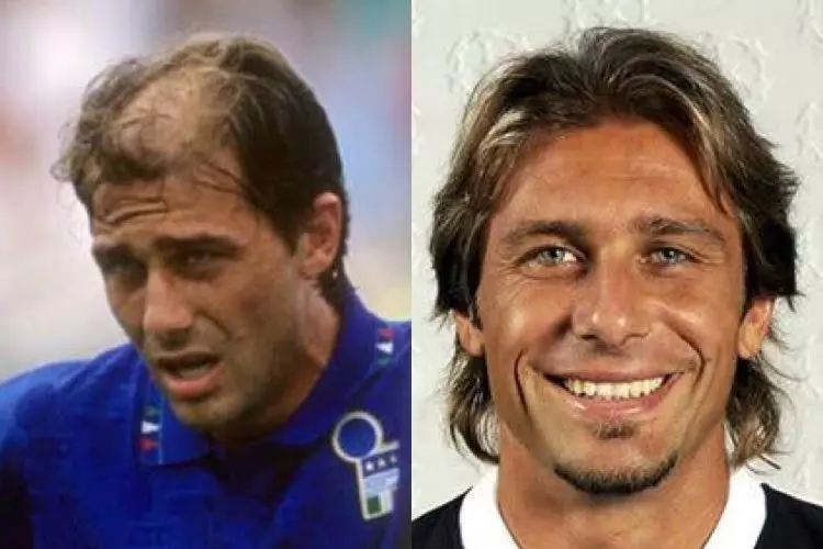 عکس؛ تغییر چهره جالب آنتونیو کونته از سال 1994 تا 2003