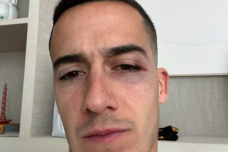 عکس؛ کبودی اطراف چشم مدافع رئال مادرید پس از بازی با سویا