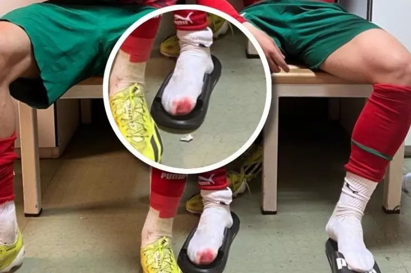 پای خونی بازیکن رئال مادرید پس از اولین بازی ملی (عکس)
